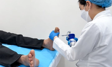 Can foot calluses be completely cured?