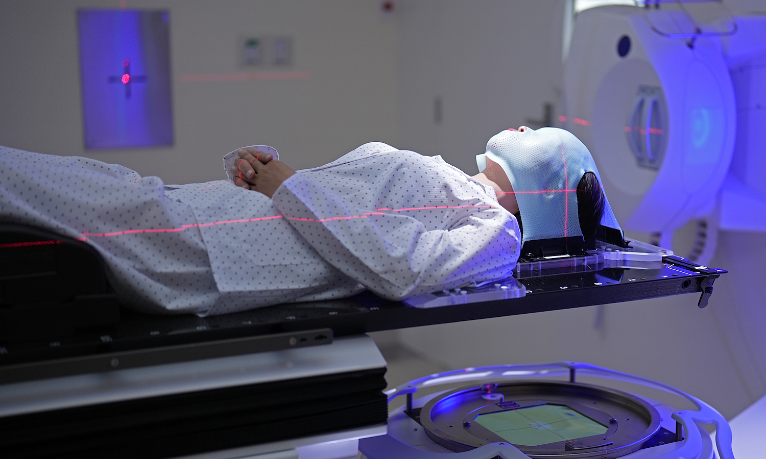 Does brain radiation therapy cause memory loss?