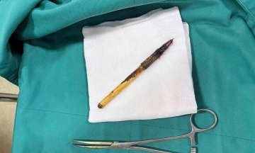 Mysterious ballpoint pen pierces boy's colon