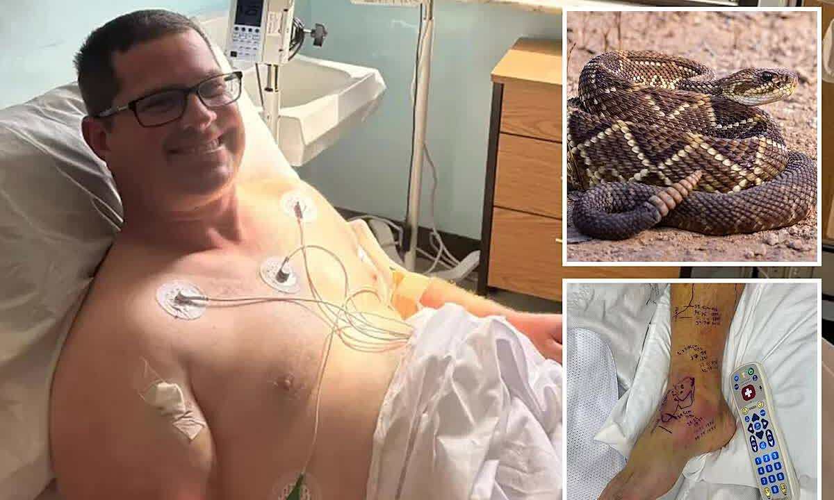 Shocked by a 1.3 million USD hospital bill after rattlesnake bite