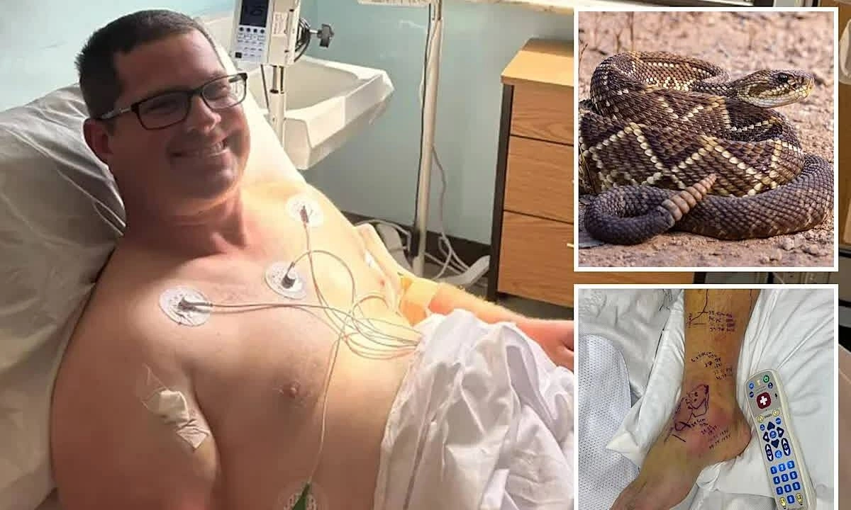 Shocked by a 1.3 million USD hospital bill after rattlesnake bite