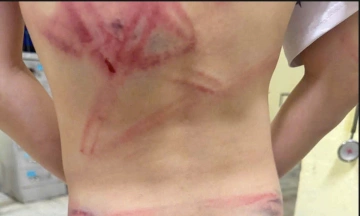 Father beats 9-year-old son, hospitalizing him for forgetting school bag