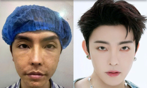Young man's 'transformation' after 20 cosmetic surgeries