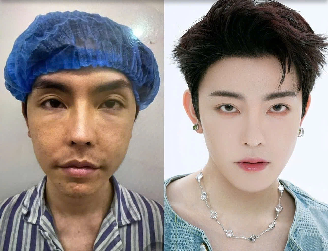 Young man's 'transformation' after 20 cosmetic surgeries