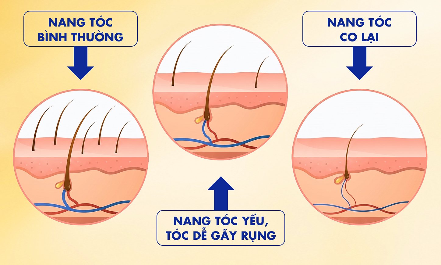 Does hair dyeing cause increased hair loss?