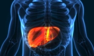 Emergency hospitalization after taking 'herbal' liver detox medicine