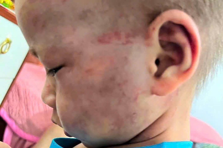 Stepfather detained for allegedly beating three-year-old stepson, causing concussion