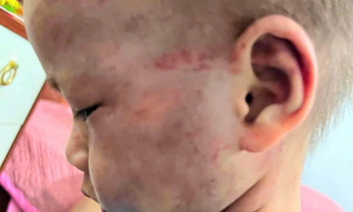 Stepfather detained for allegedly beating three-year-old stepson, causing concussion