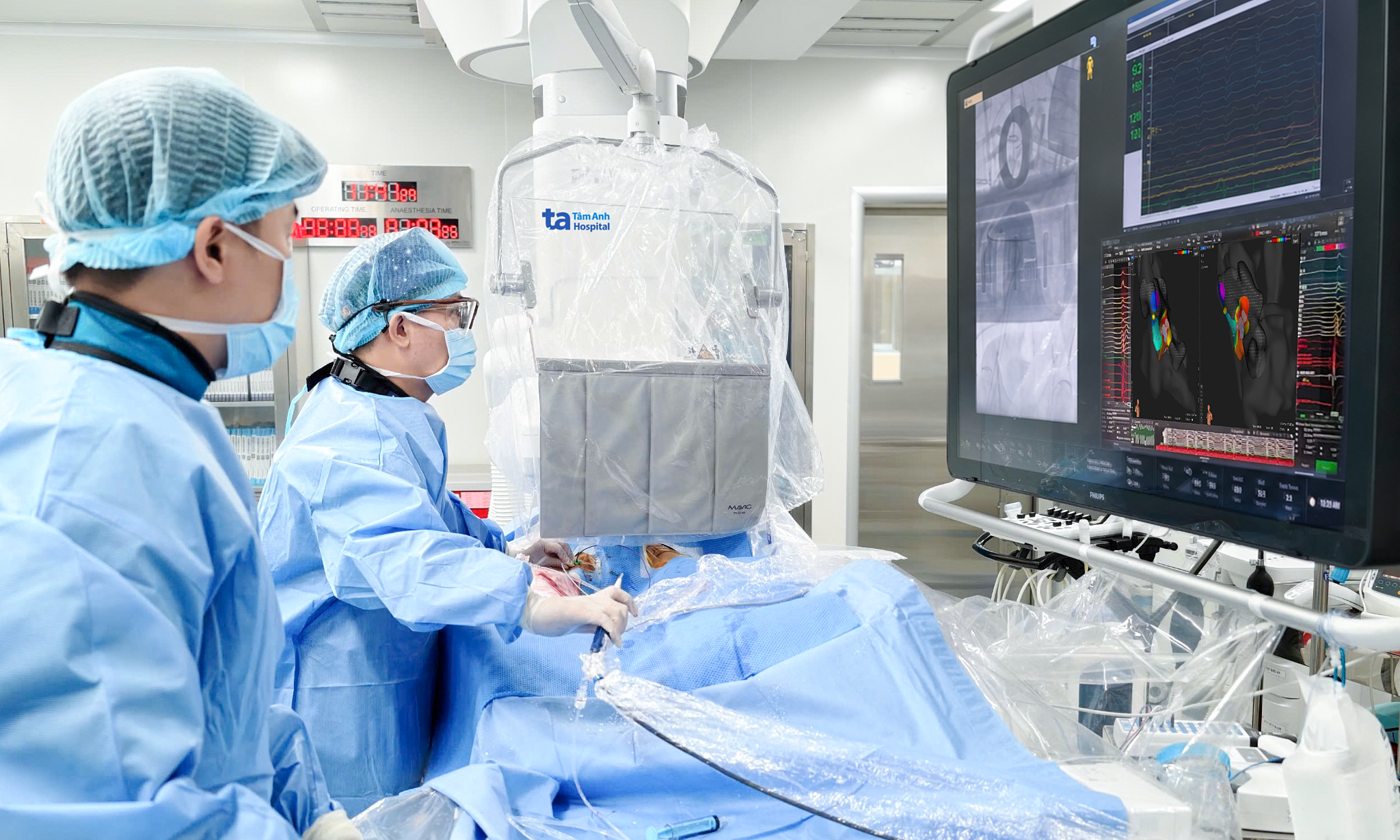 3D electrode mapping for arrhythmia treatment