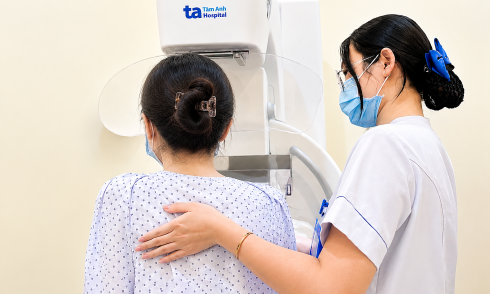 Breast nodule progresses to cancer