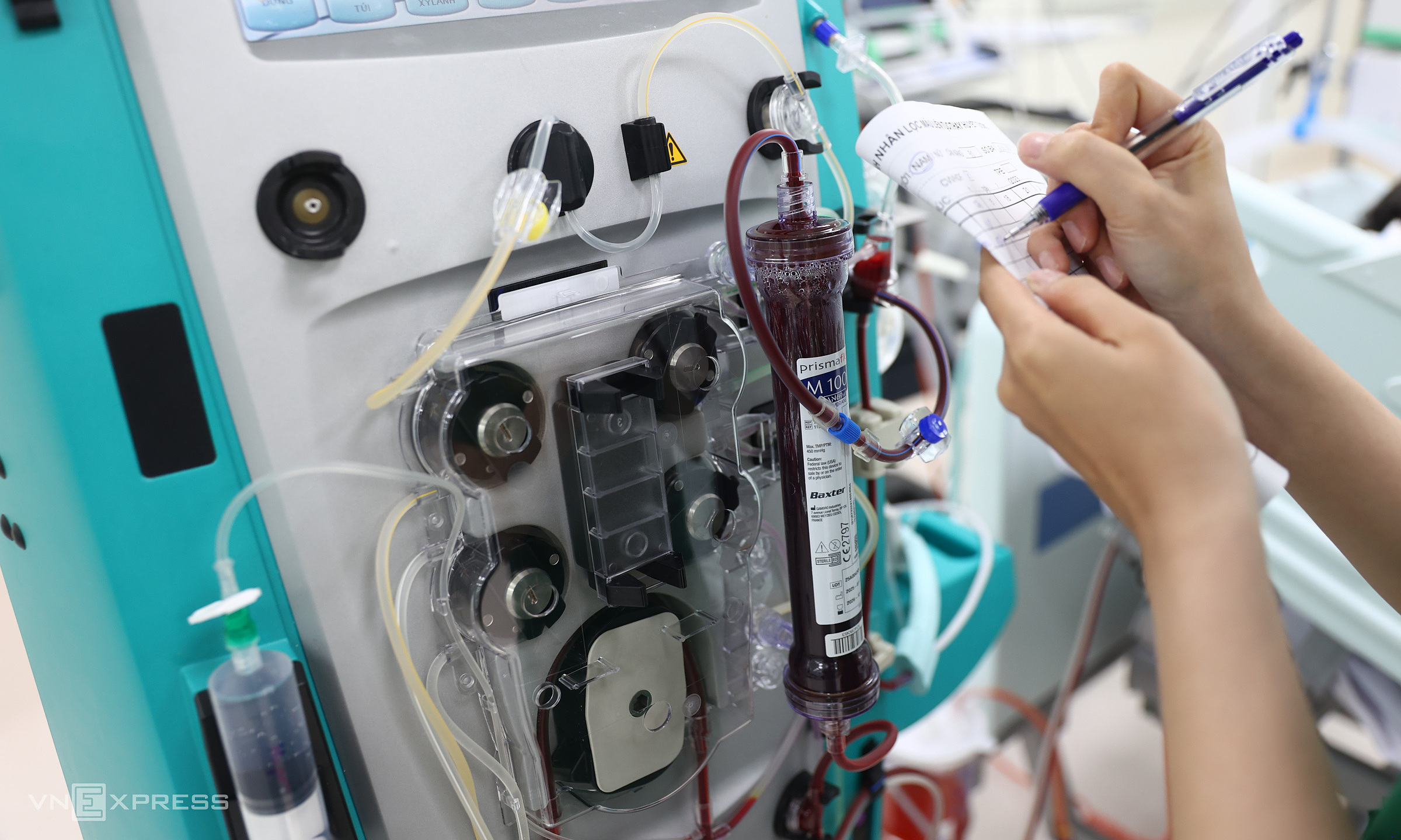 4-year-old boy needs plasma exchange after frequent paracetamol use