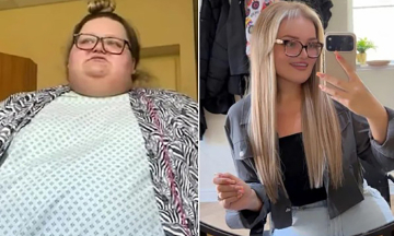 Warned 'unlikely to live past 30', woman loses 156 kg