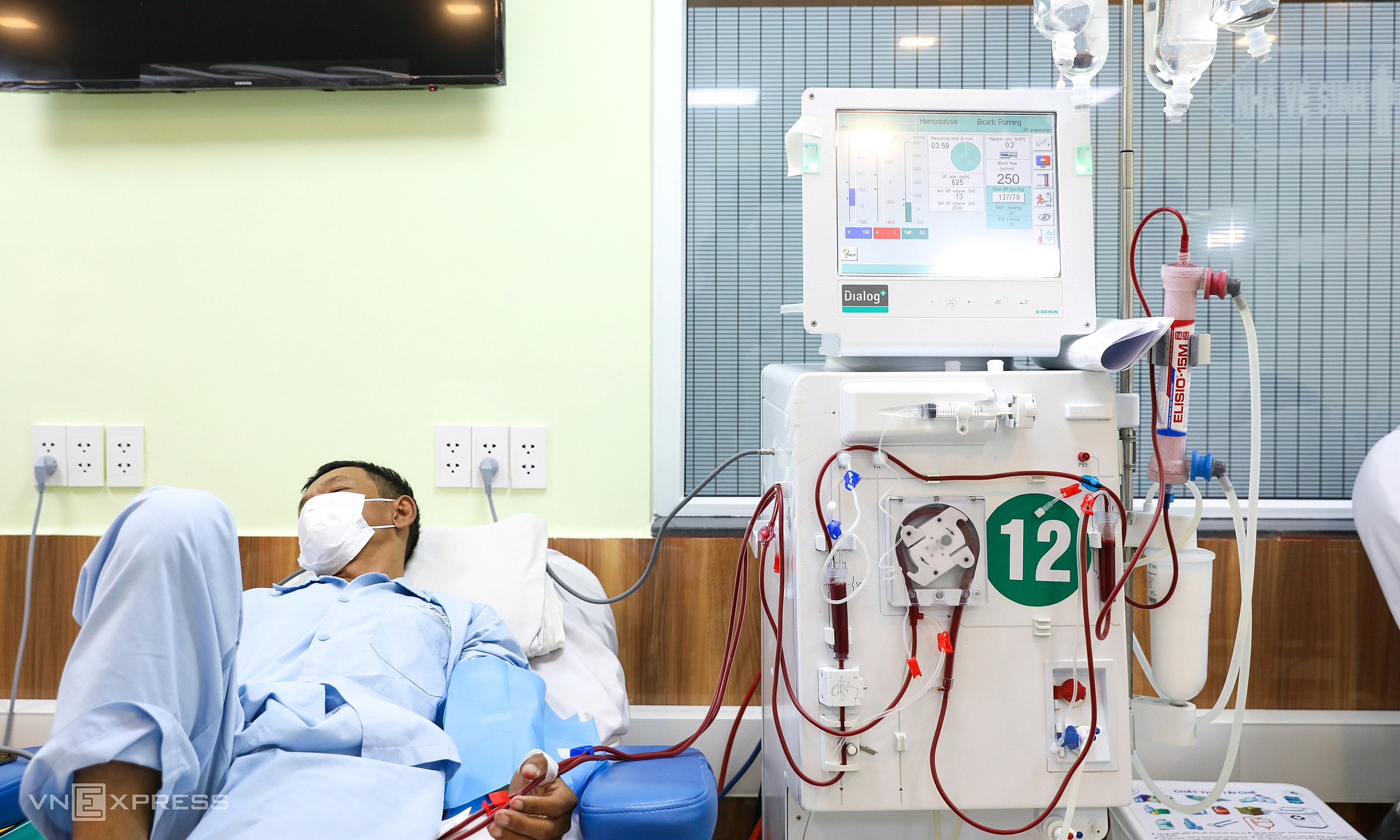 Kidney stones can silently cause kidney failure