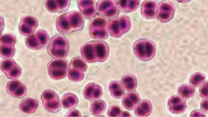 Contracting gonorrhea after oral sex with a one-night stand