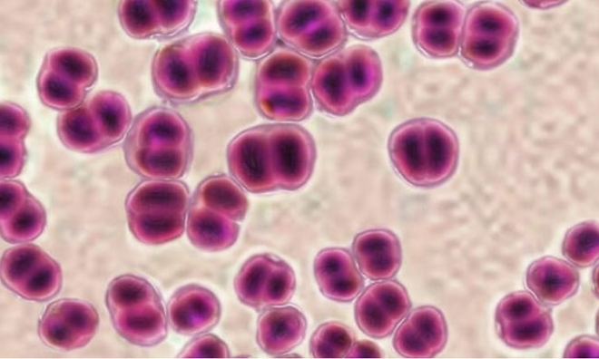 Contracting gonorrhea after oral sex with a one-night stand