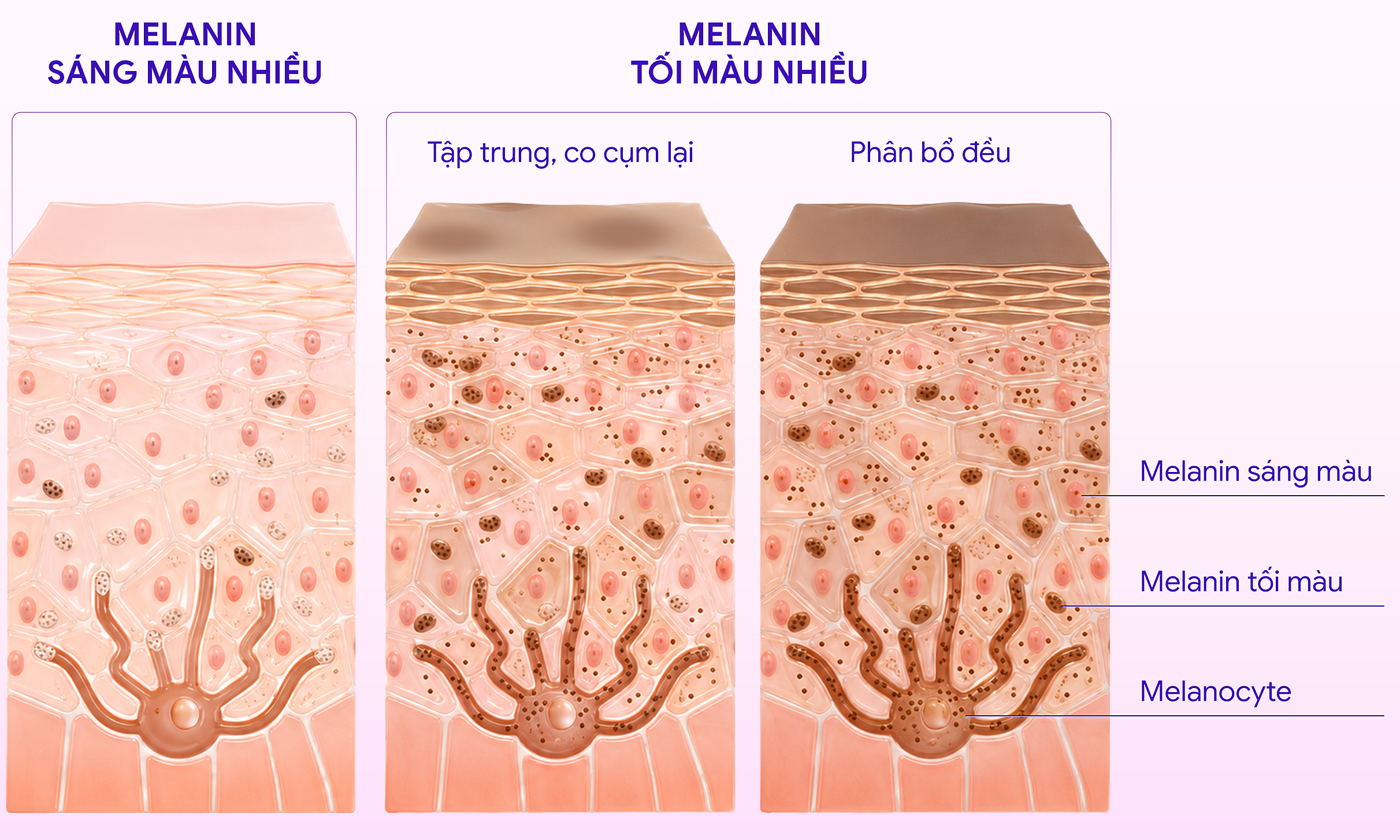 How melasma forms
