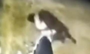 Stray dog attacks 6-year-old boy, causing severe injuries