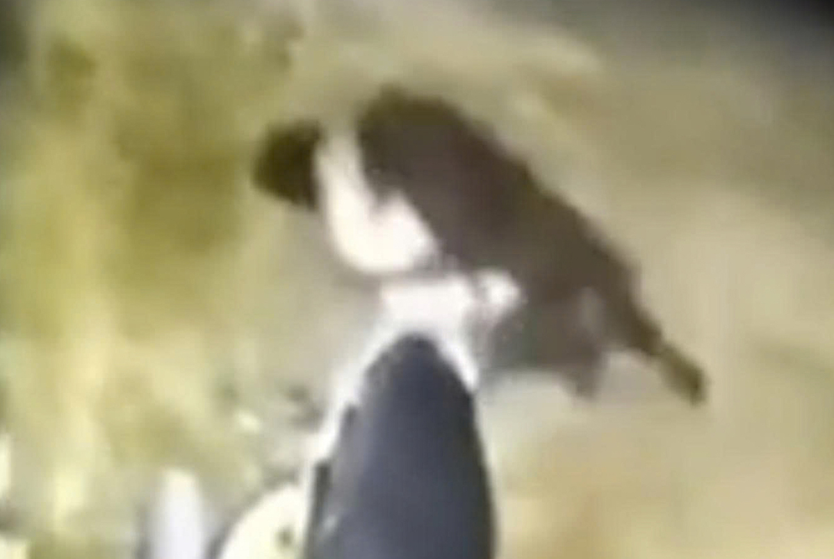 Stray dog attacks 6-year-old boy, causing severe injuries