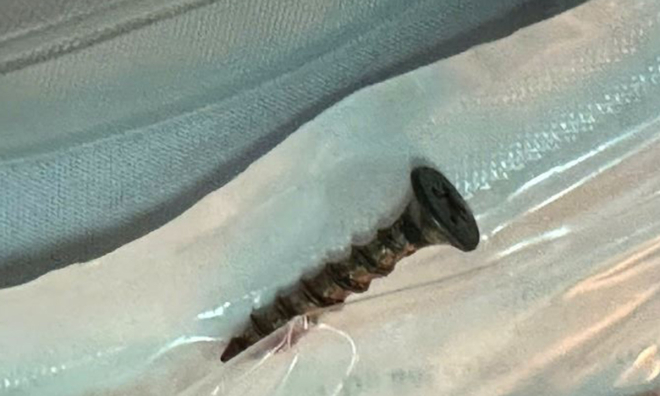 4 cm screw lodged in infant's airway