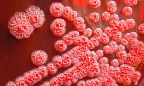 Parotid abscess leads to unexpected discovery of "flesh-eating bacteria" infection