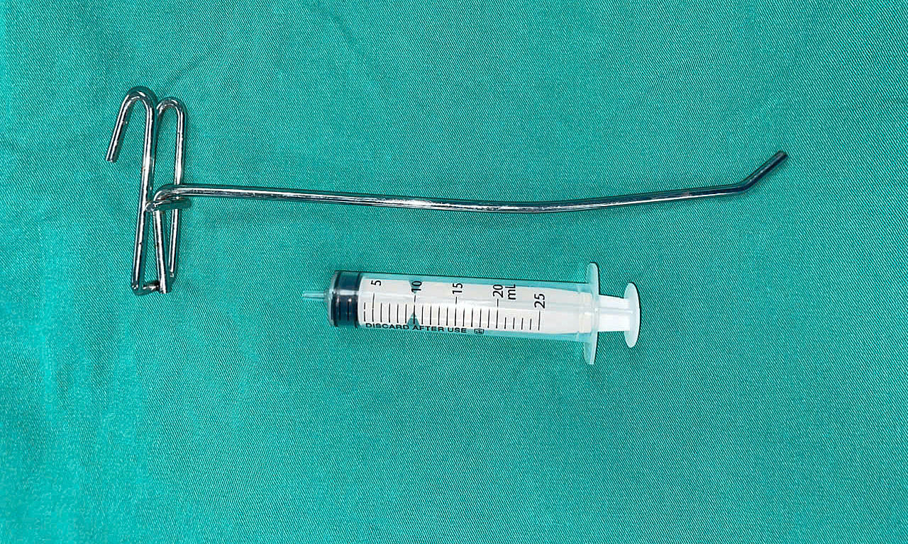 Man impaled by metal rod in eye saved
