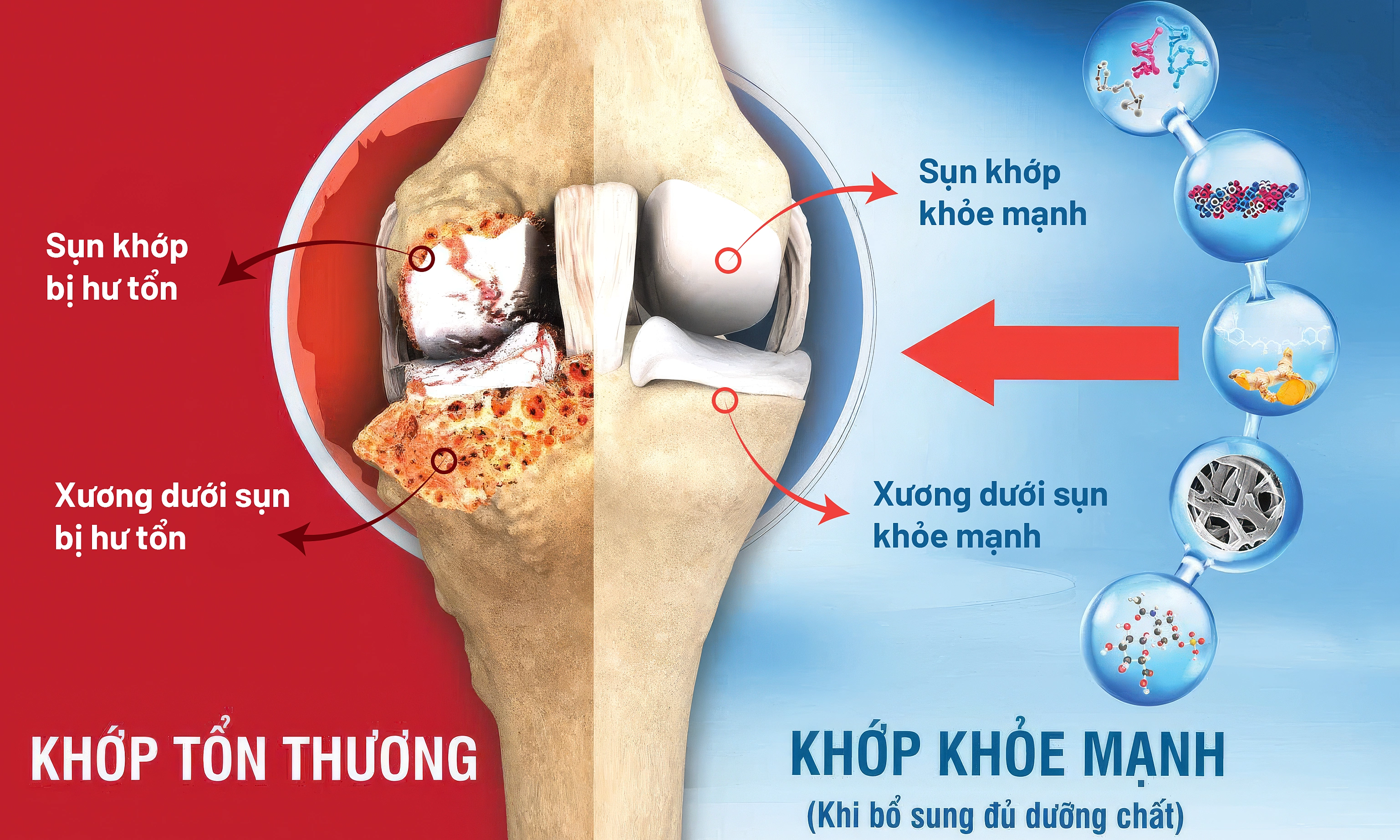 Why does joint pain occur with changing weather?