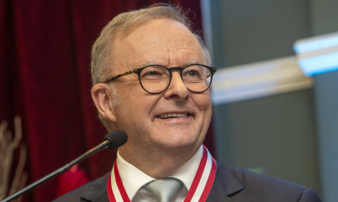 Australian prime minister anticipates welcoming General Secretary, President To Lam