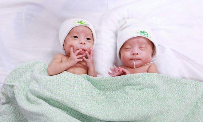 Premature twins 'fight to live' from birth