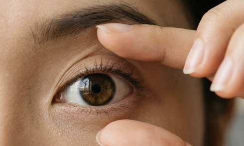 8 eye conditions that can be caused by lupus