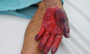 When can allergies be life-threatening?