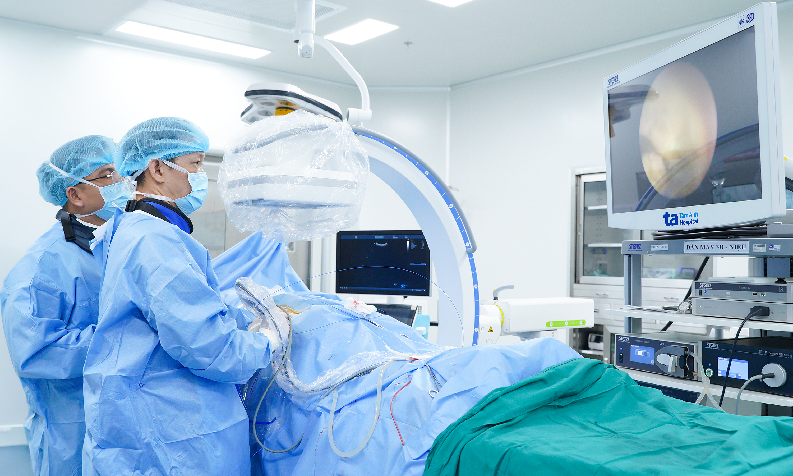 Coral kidney stones completely removed using a small percutaneous tunnel