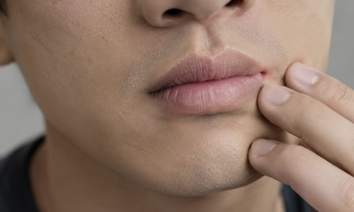 Facial changes that seem harmless but signal illness