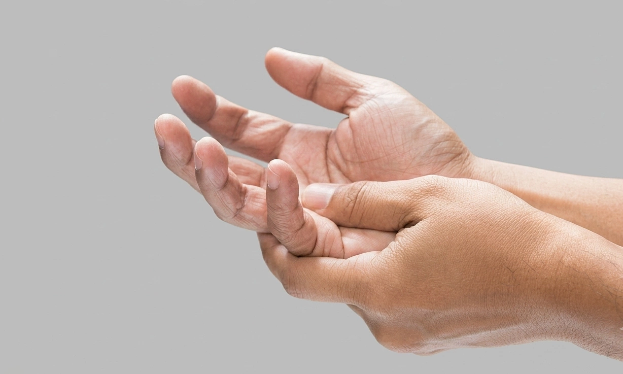 Abnormal extra-articular signs may indicate high uric acid