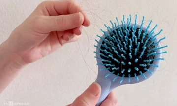 What nutrient deficiencies cause significant hair loss?