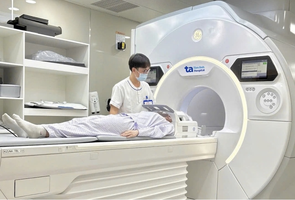 When do people under 45 need stroke screening?