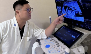 Umbilical cord blood sampling in fetuses helps early detection of Thalassemia