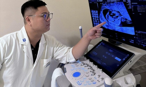 Umbilical cord blood sampling in fetuses helps early detection of Thalassemia