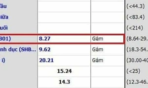 Hypogonadism at 28 due to excessive soda consumption, sedentary lifestyle