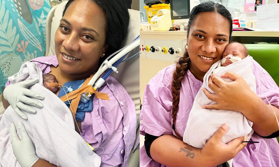 Born at 21 weeks, 351 gram baby girl miraculously survives