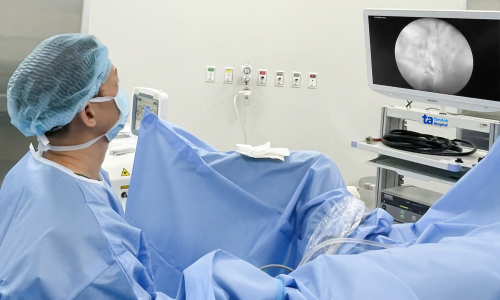 Cluster of 9 tumors found in elderly woman's bladder