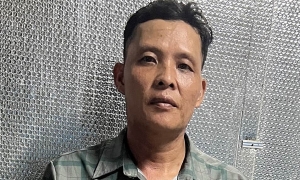 Man burns ex-wife over jealousy