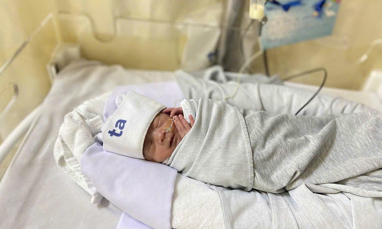 Premature baby born en caul with respiratory distress