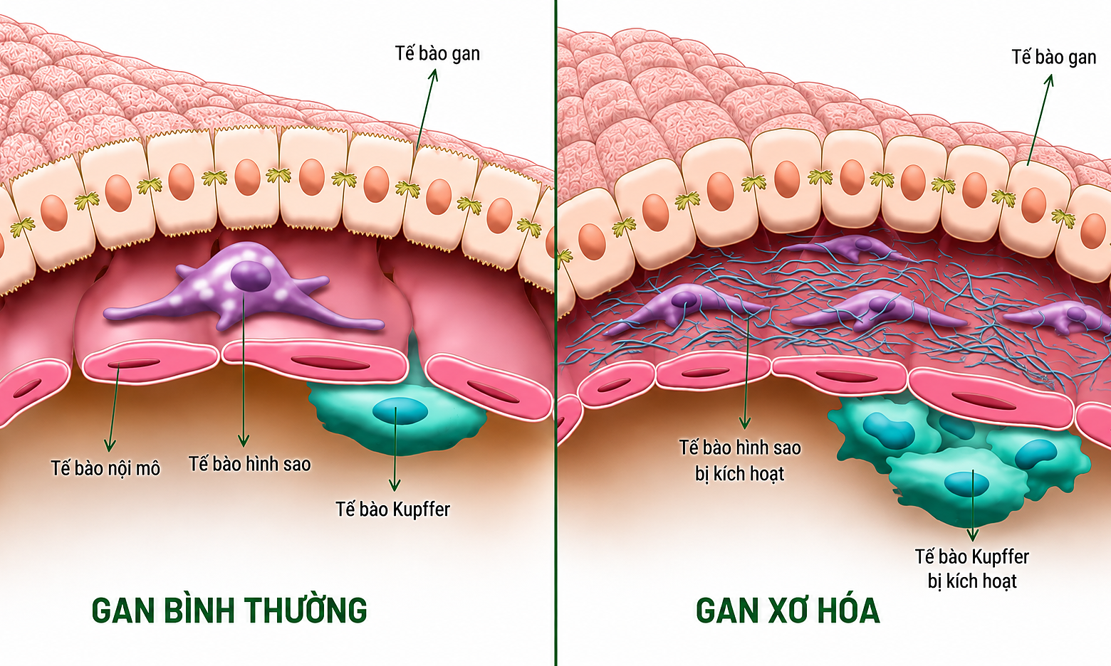 Simple ways to reduce high liver enzymes