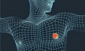 Can men develop breast cancer?
