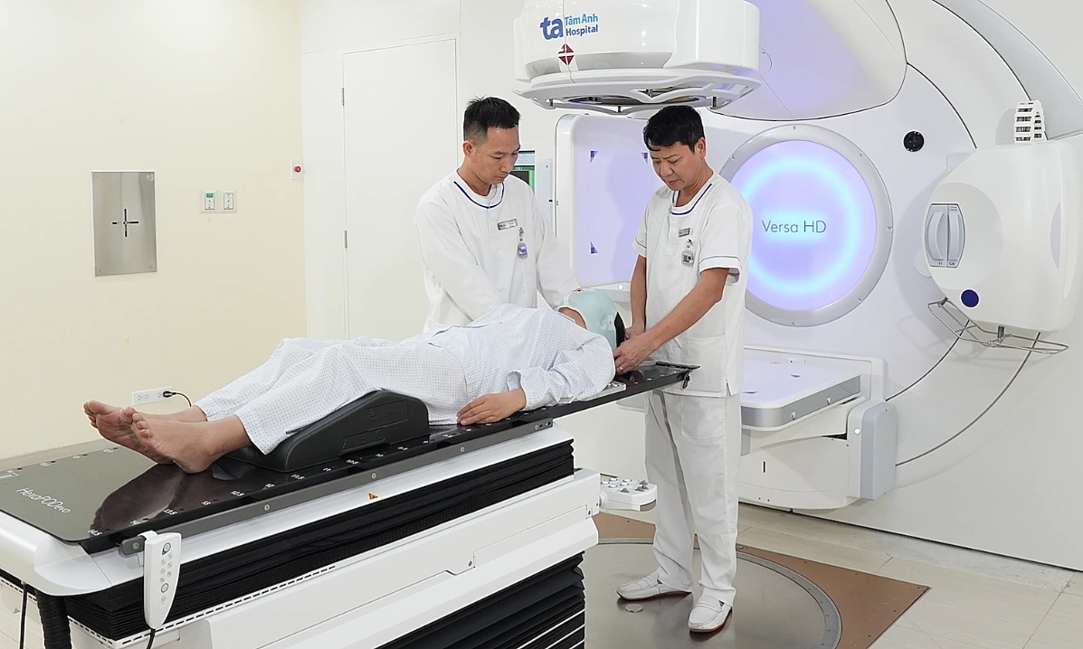 When is radiation therapy needed for tongue cancer?