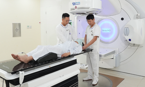 When is radiation therapy needed for tongue cancer?