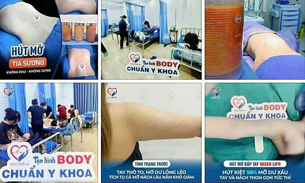 6 individuals posing as doctors administered anesthesia, performed liposuction on clients in Hanoi