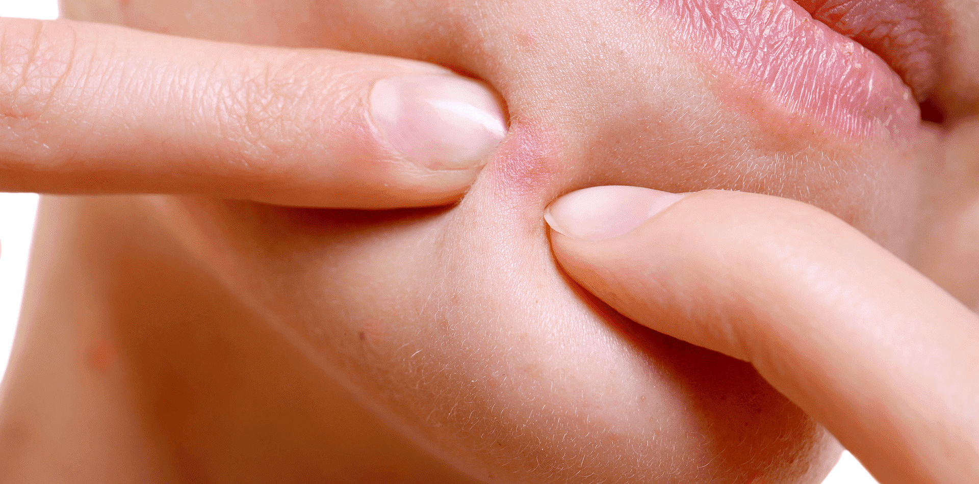 Face 'stung like a bee' due to rapid beauty treatment before school starts