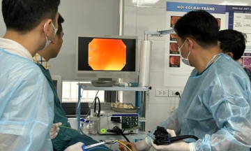 Digestive cancer accounts for over 37% of cancer deaths in Vietnam