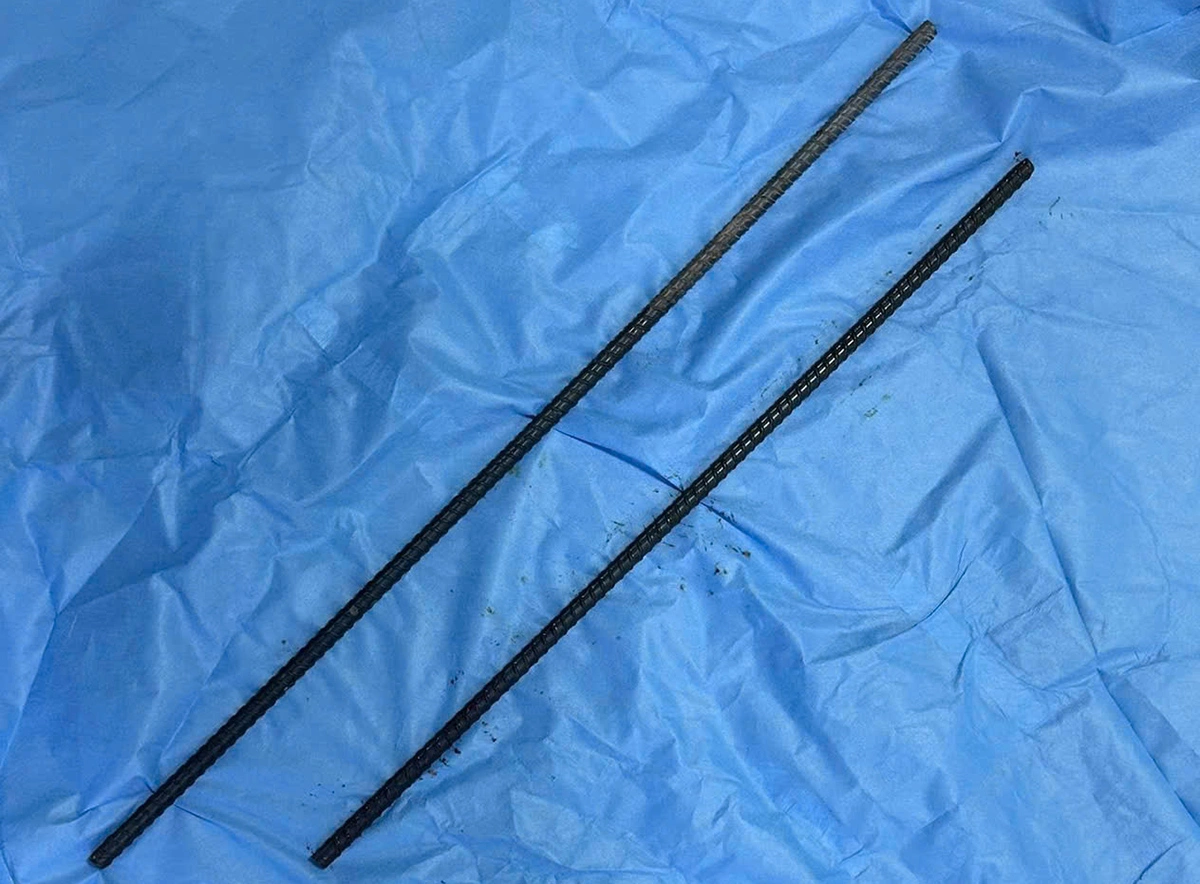 Man saved after two iron rods pierce his body